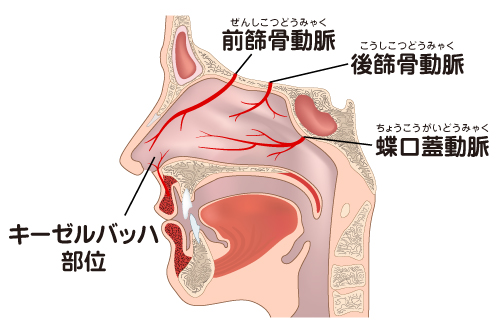 鼻出血の種類